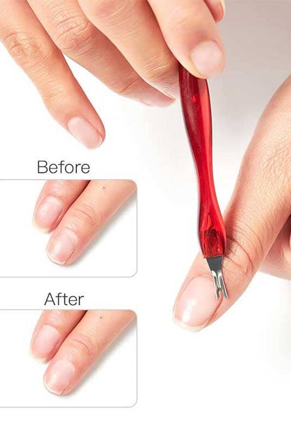 Qianluska Nail Cuticle Remover