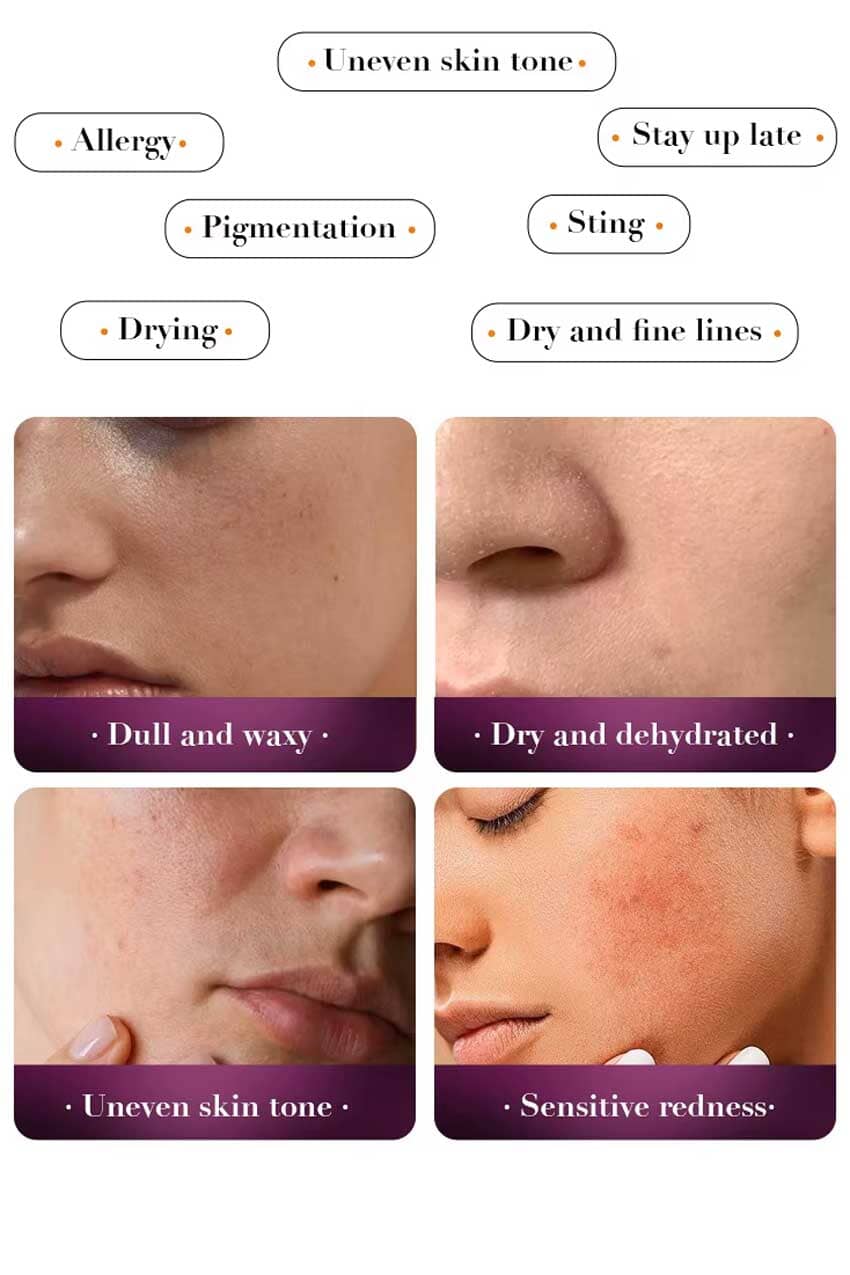 Sadoer Snail Reorganize Collagen Lotion