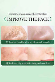 Sadoer Mugwort Anti Pores Acne Clay Stick - 40g