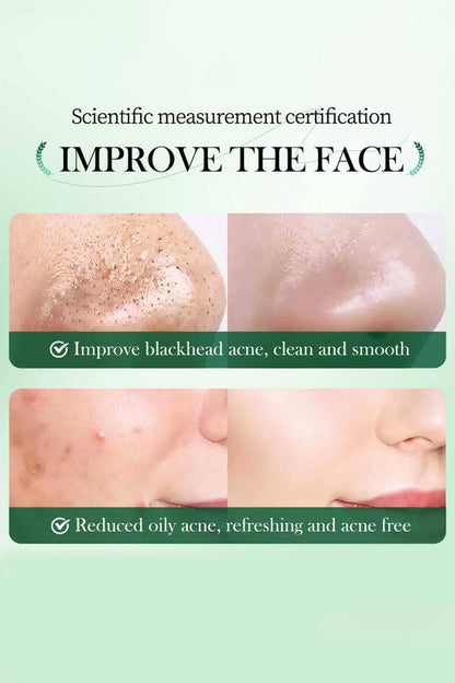 Sadoer Mugwort Anti Pores Acne Clay Stick - 40g