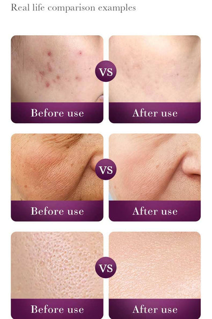 Sadoer Snail Reorganize Collagen Toner - 120ml