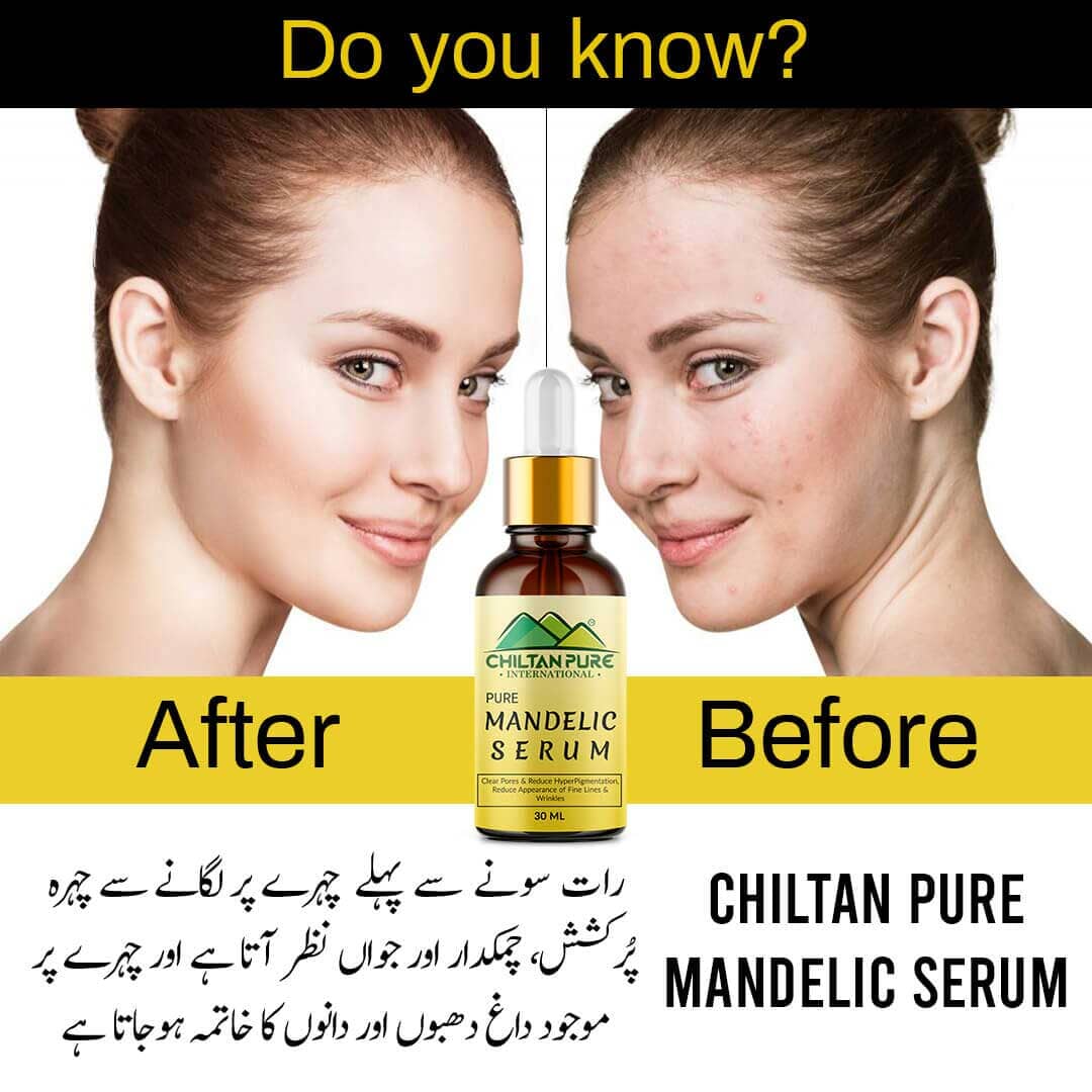 Chiltan Pure Mandelic Serum – Get Brighter & Luminous Complexion - 30ml Health & Beauty CNP 