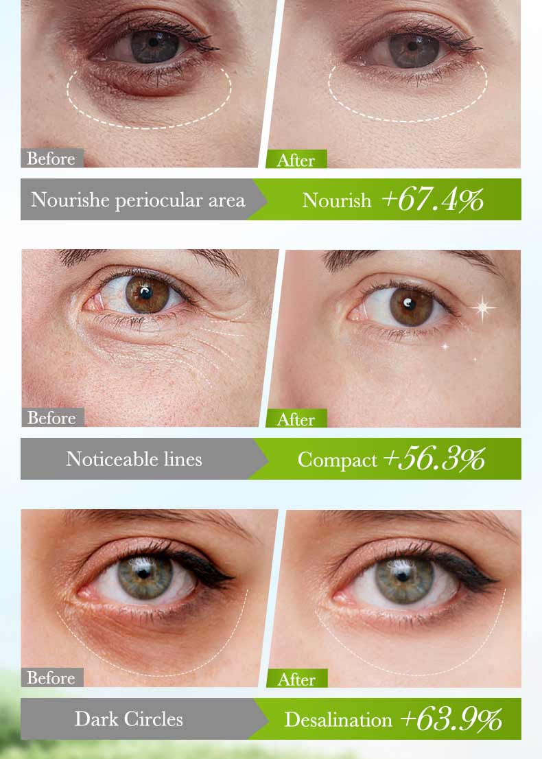 Sadoer Bamboo Charcoal Collagen Eye Mask - 80g