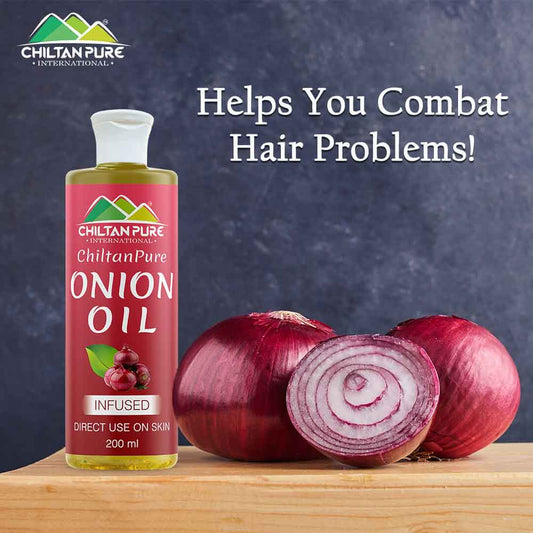 Chiltan Pure Onion Infused Hair Oil - 200 ml Health & Beauty CNP 