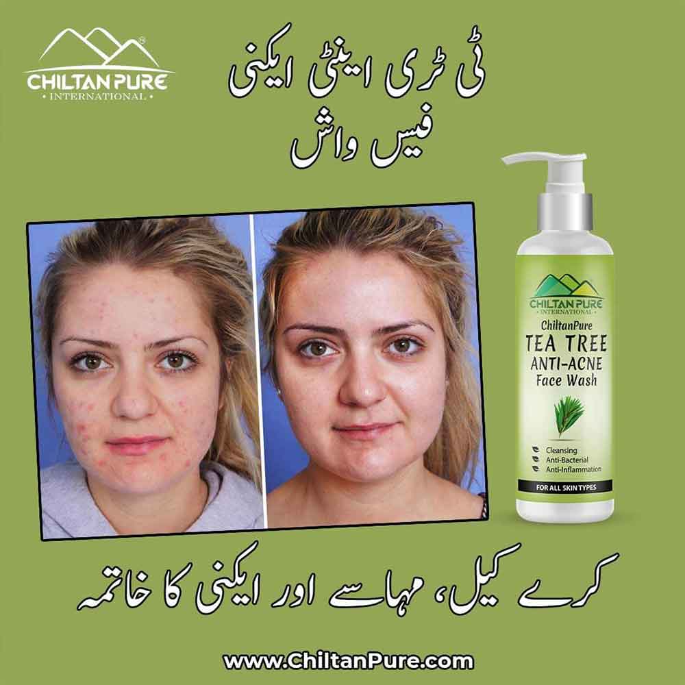 Chiltan Pure Tea Tree Acne Face Wash -150 ml Health & Beauty CNP 